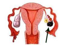 备孕一般多久能怀上？如何增加受孕的几率？